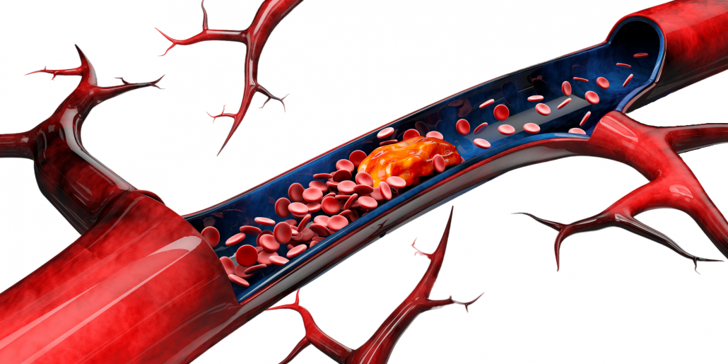 Periodontal Bone Loss Is Not A Disease